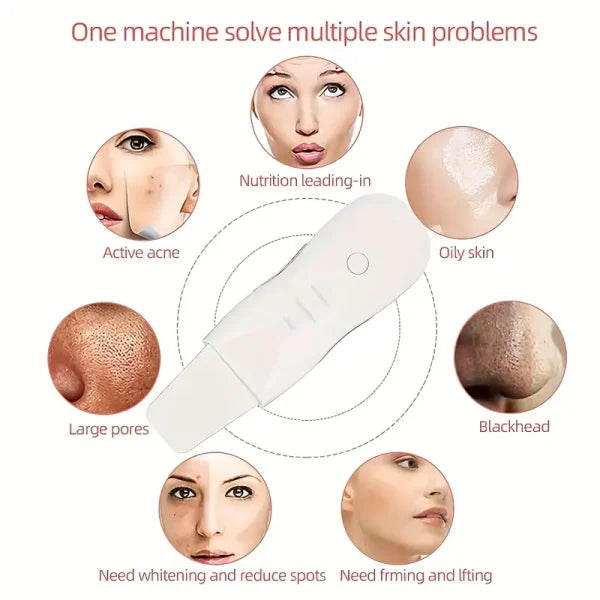 Blackhead Shovel Machine For Facial Skin Scrubber Lifting Moisturizing & Cleansing Skin Dirt Machine - With Premium Quality