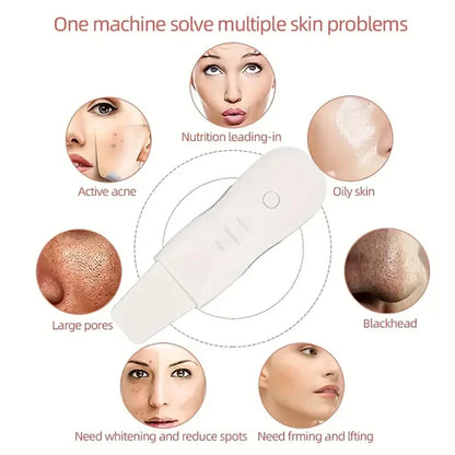 Blackhead Shovel Machine For Facial Skin Scrubber Lifting Moisturizing & Cleansing Skin Dirt Machine - With Premium Quality
