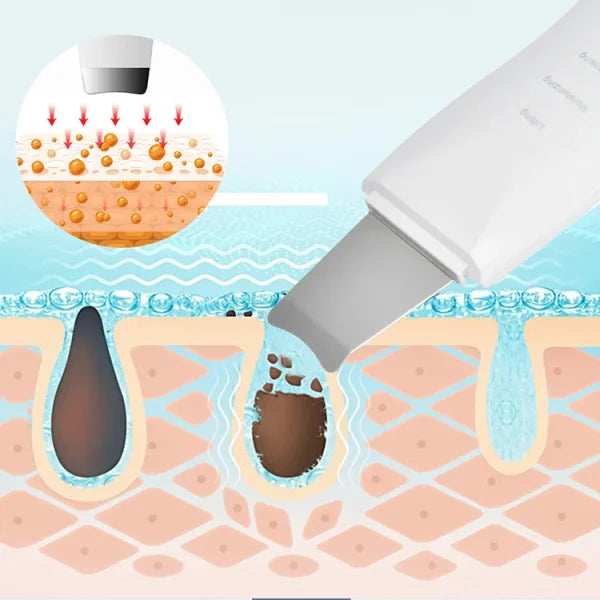 Blackhead Shovel Machine For Facial Skin Scrubber Lifting Moisturizing & Cleansing Skin Dirt Machine - With Premium Quality