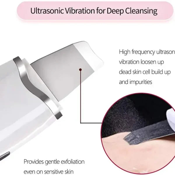 Blackhead Shovel Machine For Facial Skin Scrubber Lifting Moisturizing & Cleansing Skin Dirt Machine - With Premium Quality
