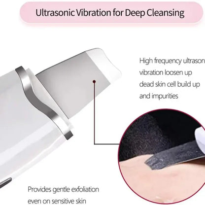 Blackhead Shovel Machine For Facial Skin Scrubber Lifting Moisturizing & Cleansing Skin Dirt Machine - With Premium Quality