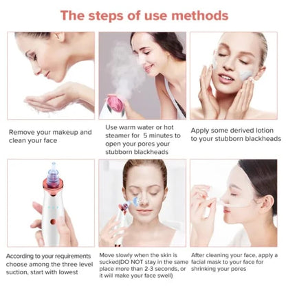 Face Vacuum Blackhead Remover Pore Cleaner | Electric Deep Cleansing Tool For Nose & Face